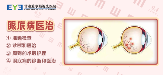 兰州治眼底病丨甘肃爱尔解答“糖网”会有什么危害(图1)