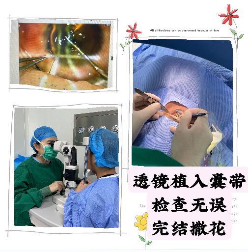 甘肃爱尔眼视光盛迅伦团队完成角膜基质透镜植入联合角膜胶原交联术(图4)