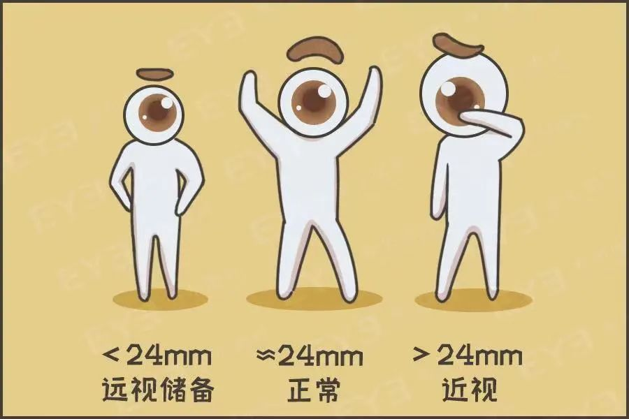 兰州爱尔范真主任科普：从“近视预防”到“近视控制”的一站式管理方案 (图1)