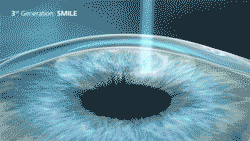 3-230413113P0N2.png