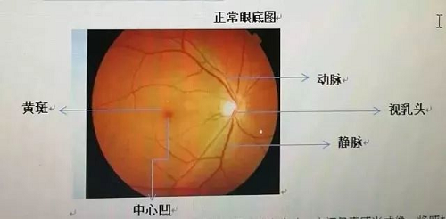 3-230420154Z5922.png