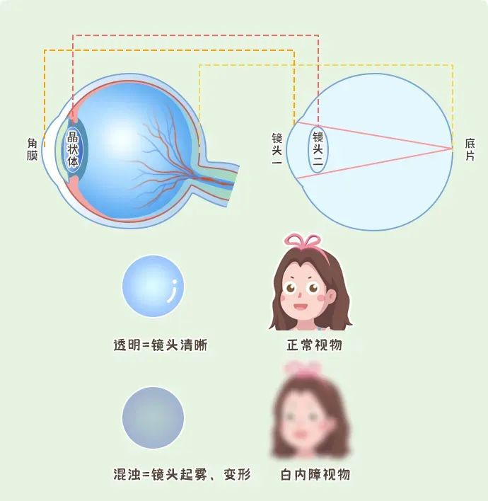 3-2305121A635321.png