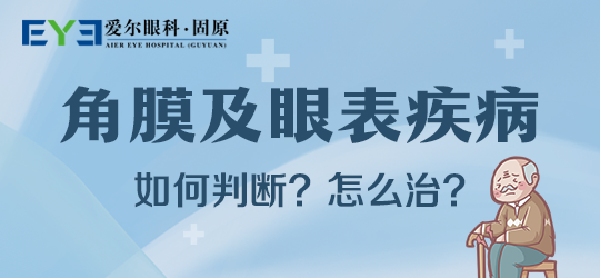 固原爱尔眼科医院：如何有效预防干眼症(图1)
