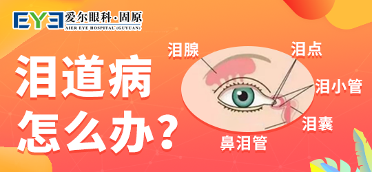 固原爱尔眼科医院：出现这样的情况可能是泪道出事了(图1)