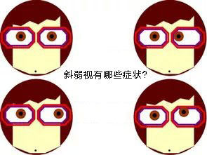 甘肃眼科：孩子看东西经常歪头、揉眼？可能是斜视了(图1)