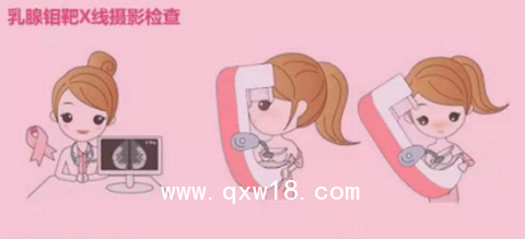 2021年中国市场乳腺钼靶X光机的五朵金花(图1)