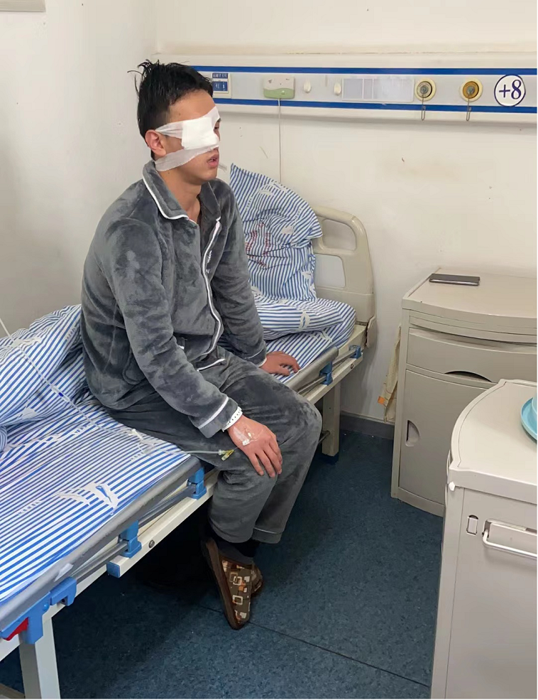 圆锥角膜折磨少年郎 角膜移植让他重见光明(图4) 圆锥角膜折磨少年郎 角膜移植让他重见光明(图4)