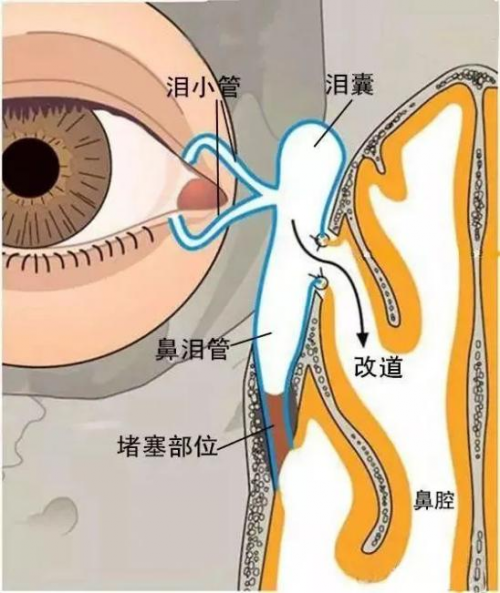 兰州爱尔范好荣主任提醒：莫名其妙流泪可不是小事！(图1)