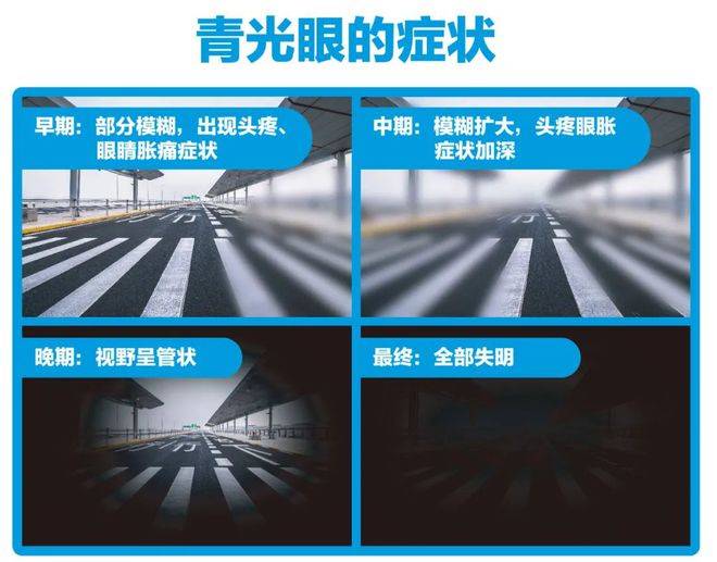 兰州爱尔眼科医院韦萍院长 :“青光眼”到底是什么？你不知道的秘密都在这里(图4)