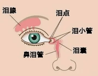 兰州爱尔眼科范好荣主任:“流泪”竟是泪道阻塞！ (图1)