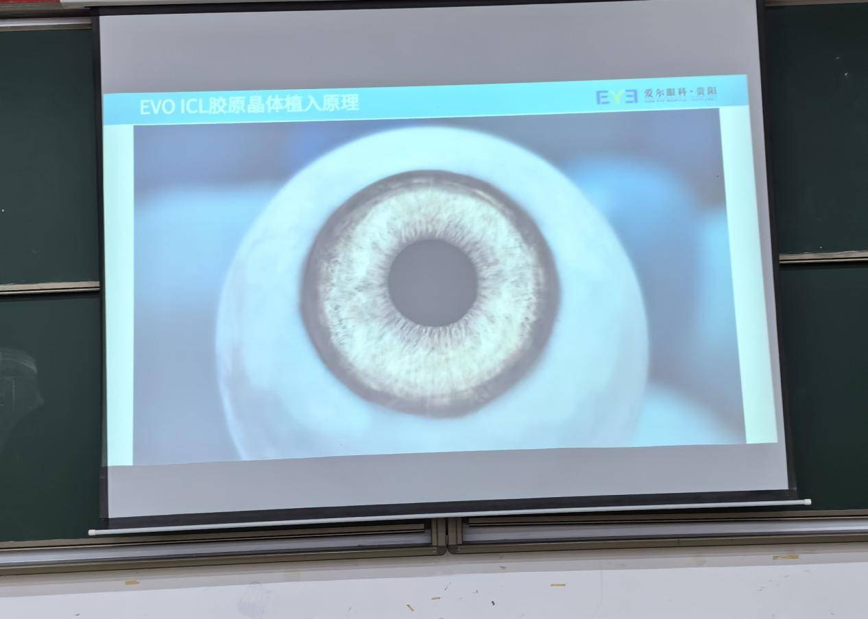 贵阳爱尔眼科医院开展“近视防治”进校园公益讲座(图3)